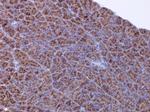 ACSL4 Antibody in Immunohistochemistry (Paraffin) (IHC (P))