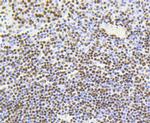 H4K5ac Antibody in Immunohistochemistry (Paraffin) (IHC (P))