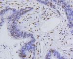 H4K5ac Antibody in Immunohistochemistry (Paraffin) (IHC (P))