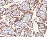 CD51 Antibody in Immunohistochemistry (Paraffin) (IHC (P))