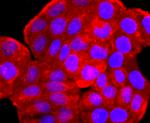 ARF6 Antibody in Immunocytochemistry (ICC/IF)