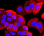 ARF6 Antibody in Immunocytochemistry (ICC/IF)