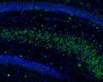 TNFR2 Antibody in Immunohistochemistry (Frozen) (IHC (F))