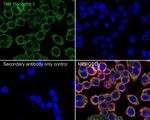 TNFR2 Antibody in Immunocytochemistry (ICC/IF)