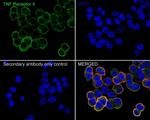 TNFR2 Antibody in Immunocytochemistry (ICC/IF)