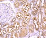 TNFR2 Antibody in Immunohistochemistry (Paraffin) (IHC (P))