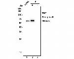 TNFR2 Antibody in Immunoprecipitation (IP)