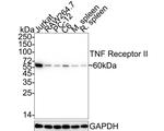 TNFR2 Antibody in Western Blot (WB)