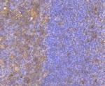 BID Antibody in Immunohistochemistry (Paraffin) (IHC (P))