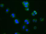 Aromatase Antibody in Immunocytochemistry (ICC/IF)