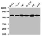 Aromatase Antibody in Western Blot (WB)