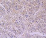 Furin Antibody in Immunohistochemistry (Paraffin) (IHC (P))