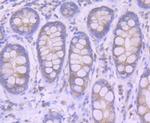 Furin Antibody in Immunohistochemistry (Paraffin) (IHC (P))