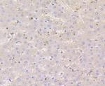 Nectin 2 Antibody in Immunohistochemistry (Paraffin) (IHC (P))