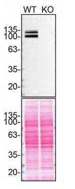 Amyloid Precursor Protein Antibody in Western Blot (WB)