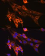 Caspase 6 Antibody in Immunocytochemistry (ICC/IF)