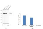 FANCD2 Antibody