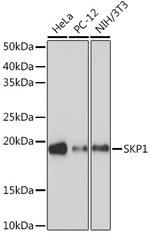 SKP1 Antibody in Western Blot (WB)