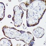 Nectin 2 Antibody in Immunohistochemistry (Paraffin) (IHC (P))