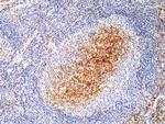 CD14 Antibody in Immunohistochemistry (Paraffin) (IHC (P))