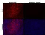 CD14 Antibody in Immunohistochemistry (Paraffin) (IHC (P))