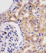 GLS2 Antibody in Immunohistochemistry (Paraffin) (IHC (P))