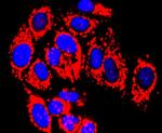 MMP13 Antibody in Immunocytochemistry (ICC/IF)