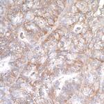 B7-H3 (CD276) Antibody in Immunohistochemistry (Paraffin) (IHC (P))