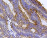 EEA1 Antibody in Immunohistochemistry (Paraffin) (IHC (P))