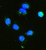 HK1 Antibody in Immunocytochemistry (ICC/IF)