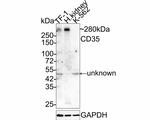 CD35 Antibody in Western Blot (WB)