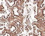 K-Ras Antibody in Immunohistochemistry (Paraffin) (IHC (P))