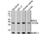 K-Ras Antibody in Western Blot (WB)