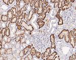 CD98 Antibody in Immunohistochemistry (Paraffin) (IHC (P))