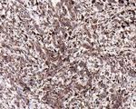 CD116 Antibody in Immunohistochemistry (Paraffin) (IHC (P))