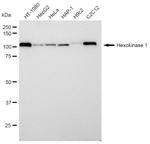 HK1 Antibody in Western Blot (WB)