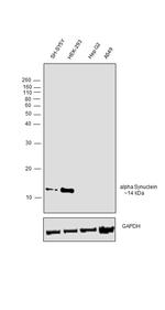 alpha Synuclein Antibody in Western Blot (WB)