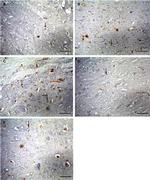 Bax Antibody in Immunohistochemistry (Paraffin) (IHC (P))