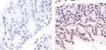 p53 Antibody in Immunohistochemistry (Paraffin) (IHC (P))