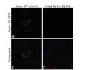 Cyclin D1 Antibody