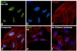 Ki-67 Antibody