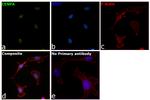 CENPA Antibody in Immunocytochemistry (ICC/IF)