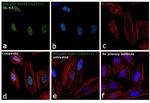 Phospho-STAT3 (Ser727) Antibody in Immunocytochemistry (ICC/IF)