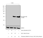 Phospho-ELK1 (Ser383) Antibody in Western Blot (WB)