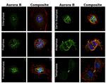 Aurora B Antibody