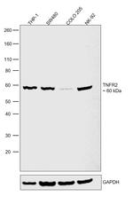 TNFR2 Antibody in Western Blot (WB)