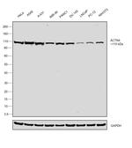 alpha Actinin 4 Antibody in Western Blot (WB)