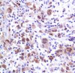 IRF4 Antibody in Immunohistochemistry (Paraffin) (IHC (P))