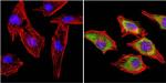 MUSK Antibody in Immunocytochemistry (ICC/IF)