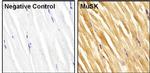 MUSK Antibody in Immunohistochemistry (Paraffin) (IHC (P))